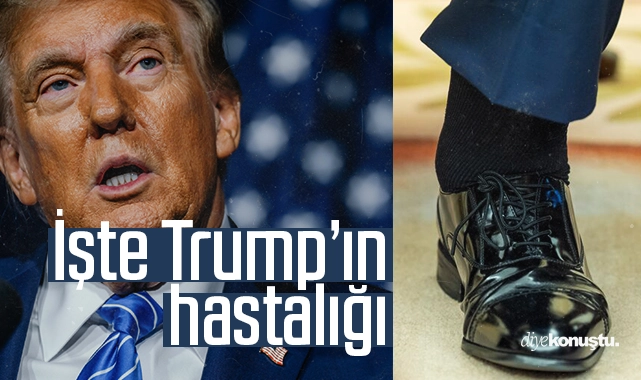 Beyaz Saray açıkladı: İşte Trump’ın hastalığı!