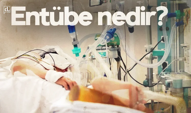 Entübe nedir? Entübe ne demek?