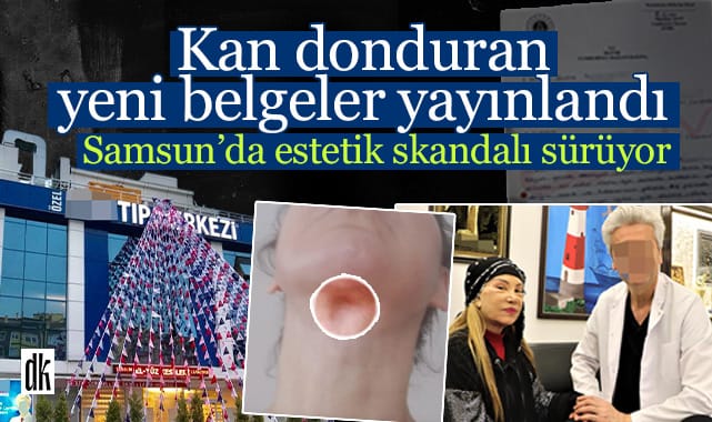 Samsun’da estetik skandalı sürüyor! Yeni belgeler yayınlandı… Kadın doktorun söyledikleri kan dondurdu…